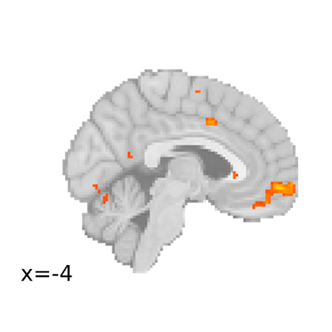 Neuro-computations of Observational Learning vs. Experiential Learning